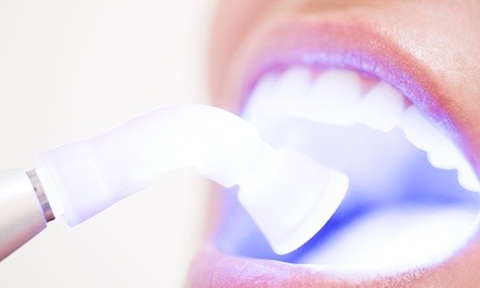 One or Two Glory White LED Teeth-Whitening Sessions at Celeste and Co. Salon and Spa (Up to 47% Off)