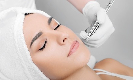 Up to 49% Off on Microdermabrasion at Aly’s Touch