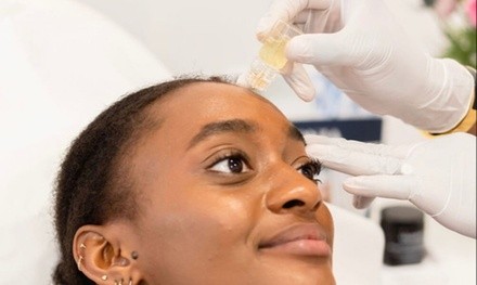 Up to 46% Off on Micro-Needling at Quenched Medical Spa
