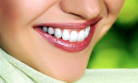 Up to 34% Off on Teeth Whitening - In-Office - Non-Branded at Natural Aesthetics