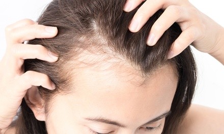 Up to 48% Off on Laser Hair Restoration at Elite Spa