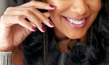 Up to 55% Off on Teeth Whitening - In-Office - Branded (Zoom, Brite Smile) at CalSmile Family Dental
