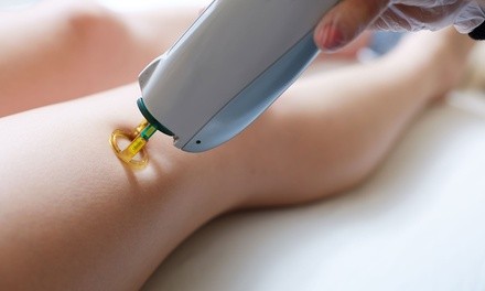 Laser Hair-Removal Sessions at Carmel Laser Studio (Up to 93% Off). Five Options Available.