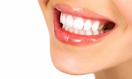 Up to 78% Off on Dental Checkup at Medplex Dental