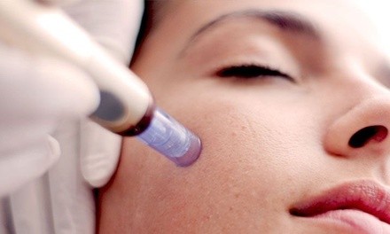 Up to 55% Off on Micro-Needling at Kjr Esthetics At Waxiitaxi