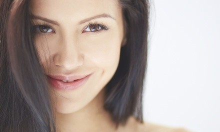 Up to 50% Off on Micro-Needling at Rejuve Cosmetic & Wellness Center