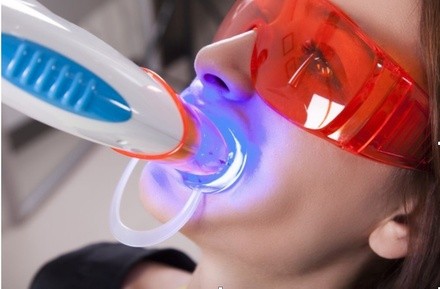 Up to 56% Off on Teeth Whitening - In-Office - Non-Branded at Baw$e Aesthetics