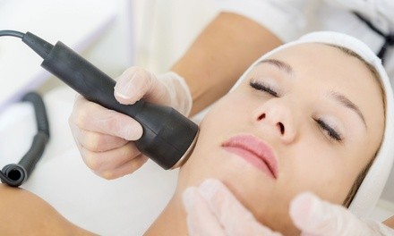 One, Two, or Four ThermaLift Skin-Tigtening Face Lifts at Lotus Spa (Up to 85% Off)