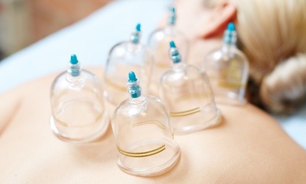 One or Three Cupping Sessions at Source Of Health Aesthetics & Wellness Center (Up to 64% Off)