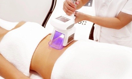 Two or Four Fat Freezing Sessions with Acoustic Wave Therapy at SlimBody Treatments (Up to 78% Off)