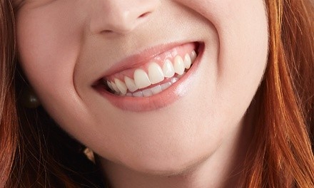 One or Two 60-Minute Organic DaVinci Teeth Whitening Treatments at Liv Beautiful (Up to 68% Off)