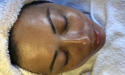 Up to 42% Off on Facial at Dikaro Aesthetics