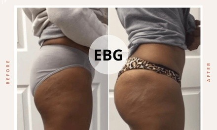 Up to 60% Off on Non-Surgical Butt Lift at ELITE Body Goals Spa