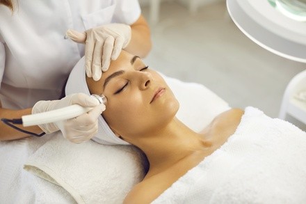 Up to 50% Off on Micro-Needling at Glowing Skin Esthetics