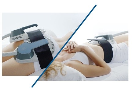 Up to 49% Off on Electrical Muscle Stimulation at Surreal Body Sculpting