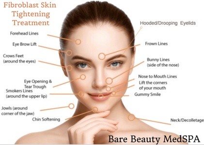 Up to 52% Off on Laser Skin Resurfacing at Bare Beauty MedSPA