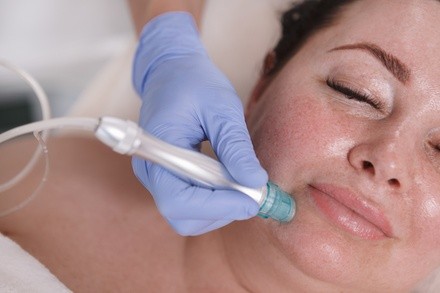 Up to 56% Off on HydraFacial at M Beauty Studio Spa