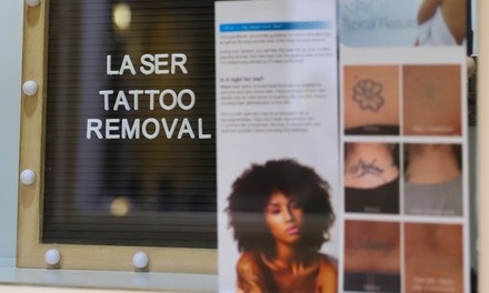 Up to 55% Off on Tattoo Removal at Miss Cassies Laser tattoo removal