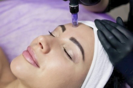 Up to 52% Off on Micro-Needling at The Skintechnician