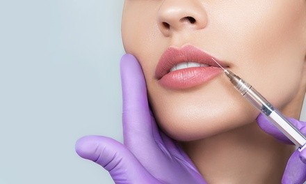 Non-Invasive Lip Enhancement Treatment at Beauty Luxe (Up to 68% Off). Two Options Available.