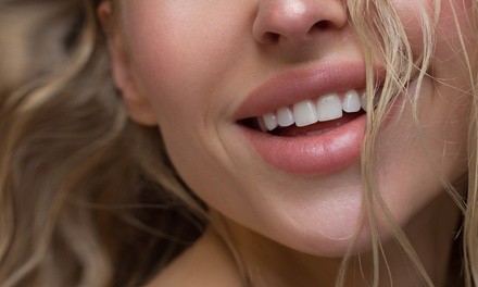 Teeth Whitening at EmbeLashed Faces (60% Off)