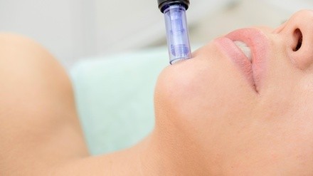 Up to 44% Off on Micro-Needling at Slayhouse Beauty