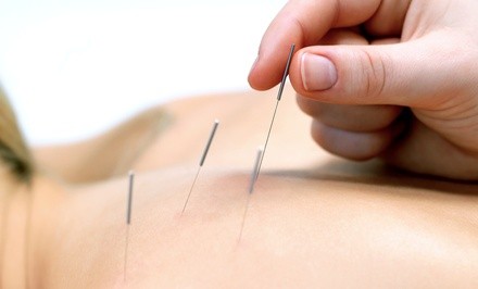 Up to 61% Off on Acupuncture at Awakening Acupuncture