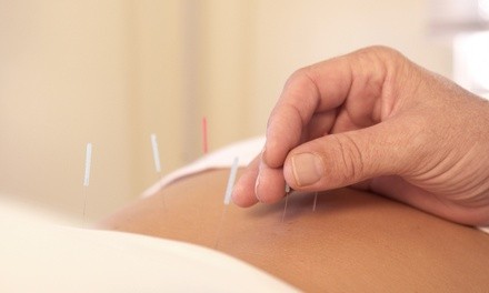 $71.50 for Two Acupuncture Treatments with Consultation at Abundant Health Acupuncture, LLC ($215 Value)