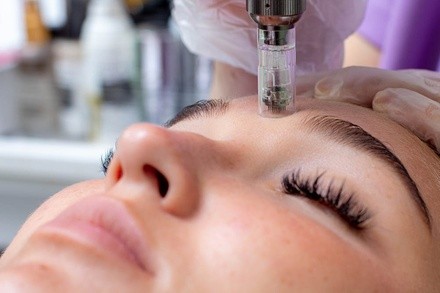 Up to 45% Off on Mesotherapy at Bella Brows and Lashes