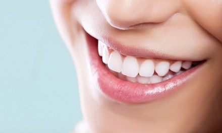 30- or 60-Minute In-Office Teeth Whitening Session or Take-Home Kit from Glam Smiles St. Louis (Up to 68% Off)