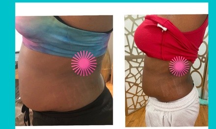 Up to 76% Off on Cavitation at TLC SELFCARE LLC