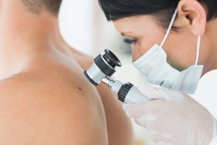 Three, Five, or 10 Mole, Skin Tag, or Spots Removals Session at Beauty Spa Soho (Up to 92% Off)