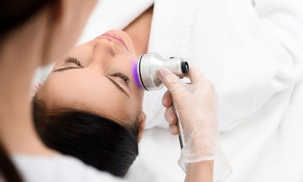 Up to 60% Off on IPL Photo Facial at Forever By Ash - West Jordan